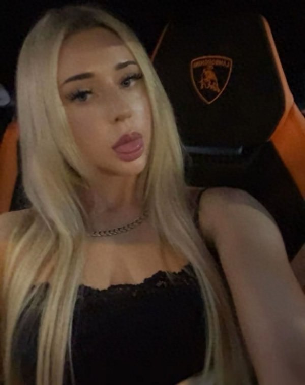 愈加教训了! 女友晒性感近照 凯-琼斯恢复: